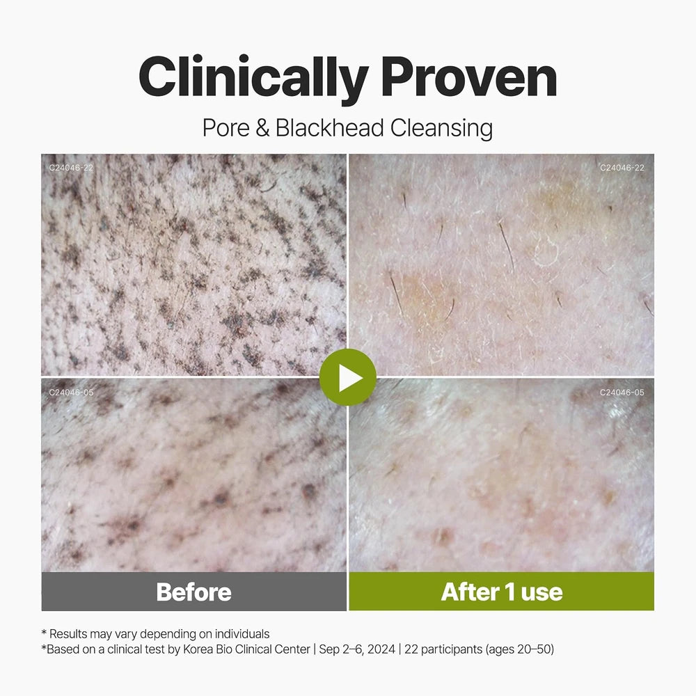 Mimié Cloud Foam™ Clay Mask