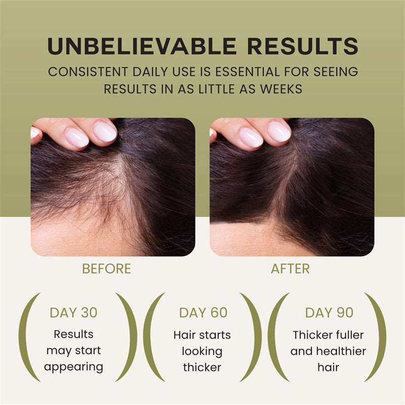 Mimié Root Nourish Oil